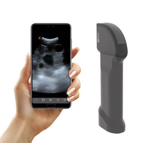 mx10 ultrasound scanner