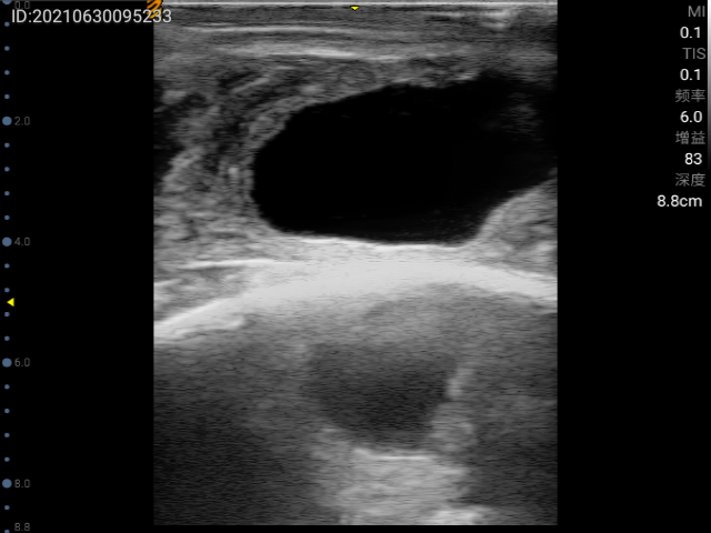 Ultrasound image sample