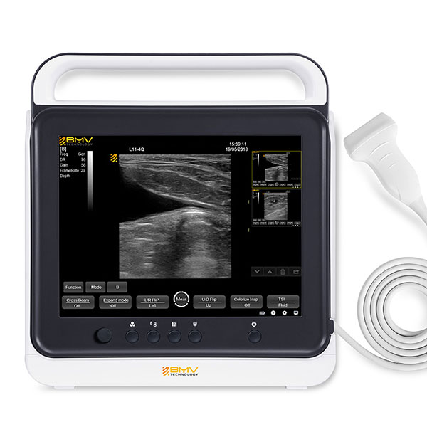 pt50a ultrasound scanner